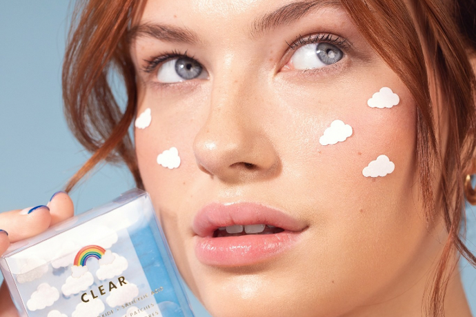 3 Blemish Treatments for Last-Minute Zits